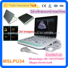MSLPU34-I 2016 Latest PC base cheapest portable ultrasound machine/3d ultrasound scanner portable laptop